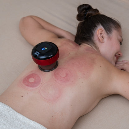 TrendRehab Elektrisk cupping 12 nivåer